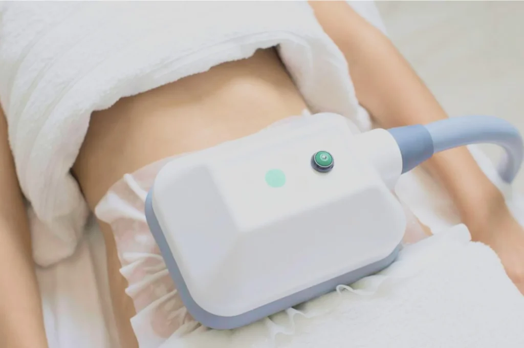 How Fat Freezing and HIFU Work Together? 3 advantages to combining Fat Freezing and HIFU Harefield