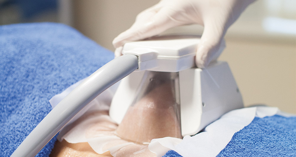 How Fat Freezing and HIFU Work Together? 2 Multiple Areas in One Session HIFU and Fat Freezing Harefield