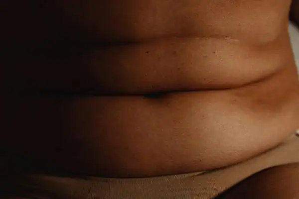 The Hidden Connection: How Stress Shapes Your Fitness and Body Composition 3 image of what stress can do on the stomach area and how Lipo 360 Harefield can help to change your body shape.