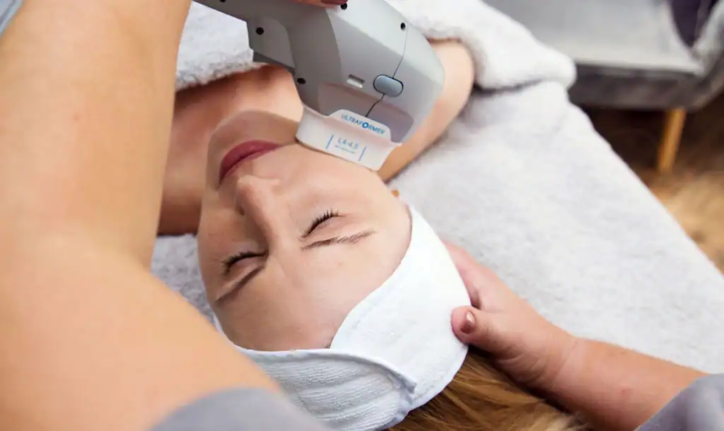 Discover the Perfect Duo: RF Microneedling and HIFU 1 Image of Morpheus8 And HIFU Harefield combined treatment